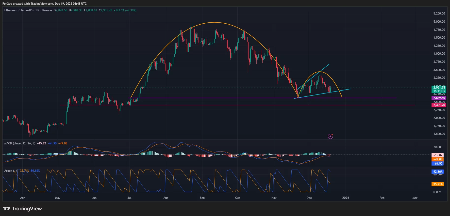 ETH price has formed multiple bearish patterns on the daily chart.